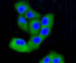 FAK Antibody in Immunocytochemistry (ICC/IF)