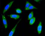 FAK Antibody in Immunocytochemistry (ICC/IF)