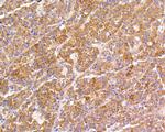 FAK Antibody in Immunohistochemistry (Paraffin) (IHC (P))