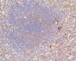 FAK Antibody in Immunohistochemistry (Paraffin) (IHC (P))