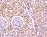 FAK Antibody in Immunohistochemistry (Paraffin) (IHC (P))