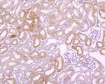 FAK Antibody in Immunohistochemistry (Paraffin) (IHC (P))