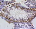 Survivin Antibody in Immunohistochemistry (Paraffin) (IHC (P))