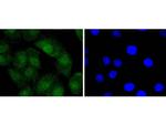 Bcl-2 Antibody in Immunocytochemistry (ICC/IF)