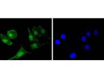 Bcl-2 Antibody in Immunocytochemistry (ICC/IF)