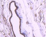 Cytokeratin 18 Antibody in Immunohistochemistry (Paraffin) (IHC (P))