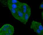 SMAD4 Antibody in Immunocytochemistry (ICC/IF)