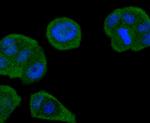 SMAD4 Antibody in Immunocytochemistry (ICC/IF)