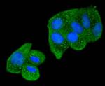 SMAD2 Antibody in Immunocytochemistry (ICC/IF)