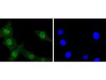 ERK1 Antibody in Immunocytochemistry (ICC/IF)