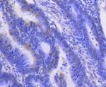 ERK1 Antibody in Immunohistochemistry (Paraffin) (IHC (P))