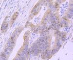 p53 Antibody in Immunohistochemistry (Paraffin) (IHC (P))