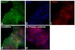 Cytokeratin 5 Antibody in Immunocytochemistry (ICC/IF)