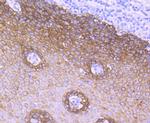 Cytokeratin 5 Antibody in Immunohistochemistry (Paraffin) (IHC (P))