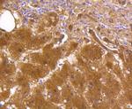 ALDH1A1 Antibody in Immunohistochemistry (Paraffin) (IHC (P))