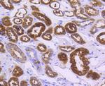 ALDH1A1 Antibody in Immunohistochemistry (Paraffin) (IHC (P))