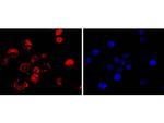 CDX2 Antibody in Immunocytochemistry (ICC/IF)