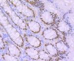 CDX2 Antibody in Immunohistochemistry (Paraffin) (IHC (P))