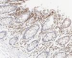 STAT1 Antibody in Immunohistochemistry (Paraffin) (IHC (P))