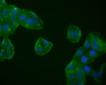 BDNF Antibody in Immunocytochemistry (ICC/IF)