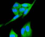 c-Met Antibody in Immunocytochemistry (ICC/IF)