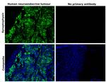 Synaptophysin Antibody in Immunohistochemistry (Paraffin) (IHC (P))