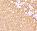 Synaptophysin Antibody in Immunohistochemistry (Paraffin) (IHC (P))