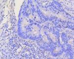 STAT3 Antibody in Immunohistochemistry (Paraffin) (IHC (P))