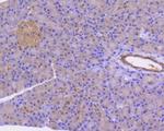 STAT3 Antibody in Immunohistochemistry (Paraffin) (IHC (P))