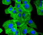 Alpha-Smooth Muscle Actin Antibody in Immunocytochemistry (ICC/IF)