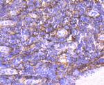 Alpha-Smooth Muscle Actin Antibody in Immunohistochemistry (Paraffin) (IHC (P))