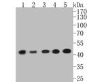 Alpha-Smooth Muscle Actin Antibody in Western Blot (WB)