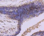 GSK3B Antibody in Immunohistochemistry (Paraffin) (IHC (P))