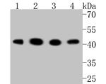 GSK3B Antibody in Western Blot (WB)