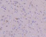 VPS34 Antibody in Immunohistochemistry (Paraffin) (IHC (P))