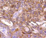 mTOR Antibody in Immunohistochemistry (Paraffin) (IHC (P))