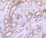 mTOR Antibody in Immunohistochemistry (Paraffin) (IHC (P))