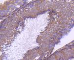 mTOR Antibody in Immunohistochemistry (Paraffin) (IHC (P))