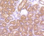 mTOR Antibody in Immunohistochemistry (Paraffin) (IHC (P))