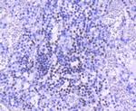 PARP1 Antibody in Immunohistochemistry (Paraffin) (IHC (P))