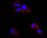 PI3K p85 alpha Antibody in Immunocytochemistry (ICC/IF)