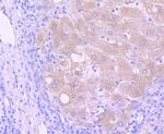 PI3K p85 alpha Antibody in Immunohistochemistry (Paraffin) (IHC (P))