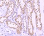 PI3K p85 alpha Antibody in Immunohistochemistry (Paraffin) (IHC (P))