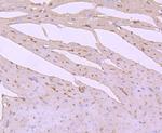 PI3K p85 alpha Antibody in Immunohistochemistry (Paraffin) (IHC (P))