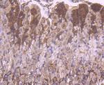 YBX1 Antibody in Immunohistochemistry (Paraffin) (IHC (P))