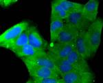 Stathmin 1 Antibody in Immunocytochemistry (ICC/IF)