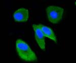 Ubiquitin Antibody in Immunocytochemistry (ICC/IF)