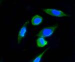 Ubiquitin Antibody in Immunocytochemistry (ICC/IF)