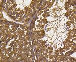 Ubiquitin Antibody in Immunohistochemistry (Paraffin) (IHC (P))