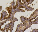 Ubiquitin Antibody in Immunohistochemistry (Paraffin) (IHC (P))